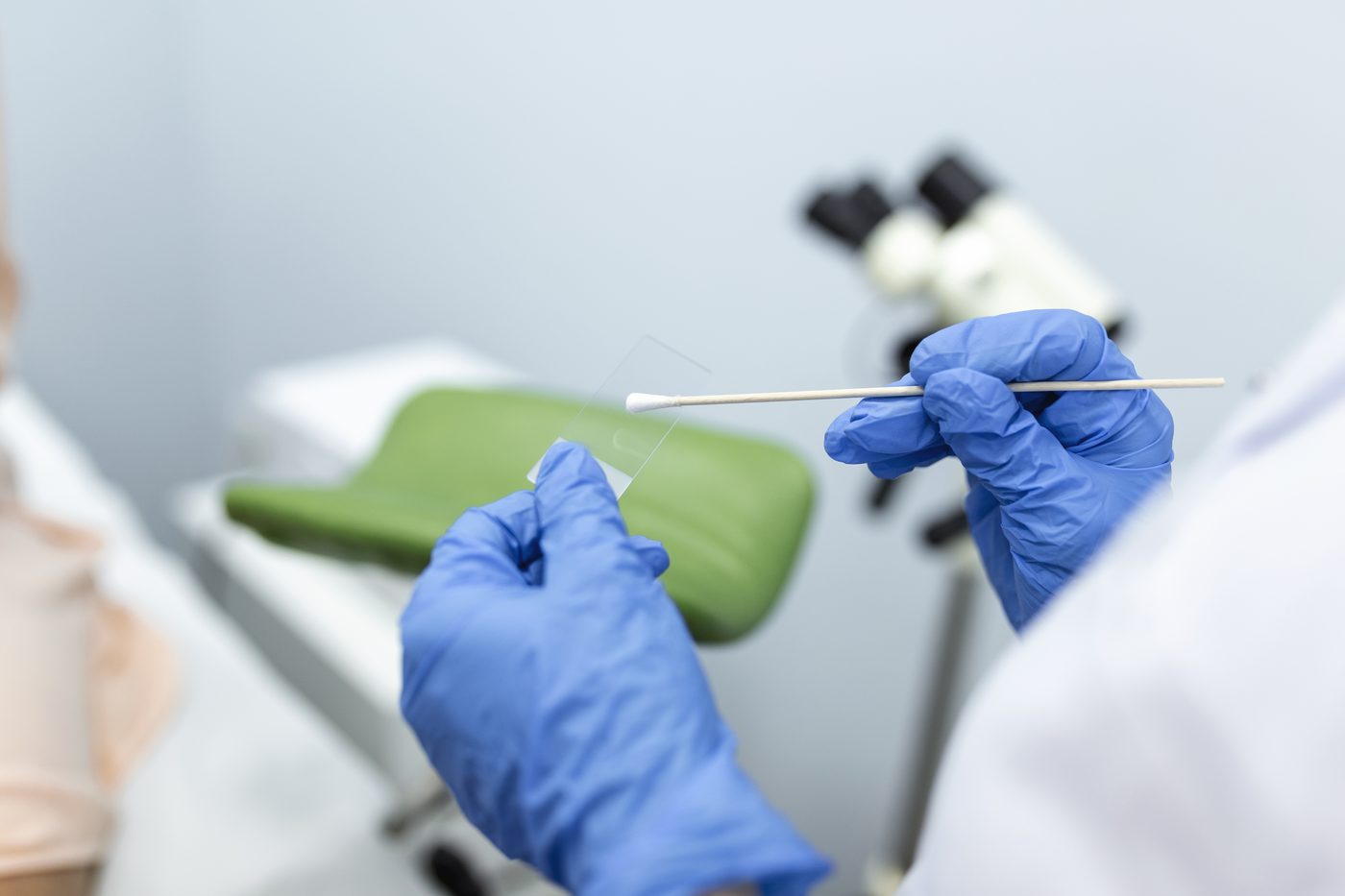 Cervical Screening Test: Who Needs One, How Often, and the Self-Collect Option