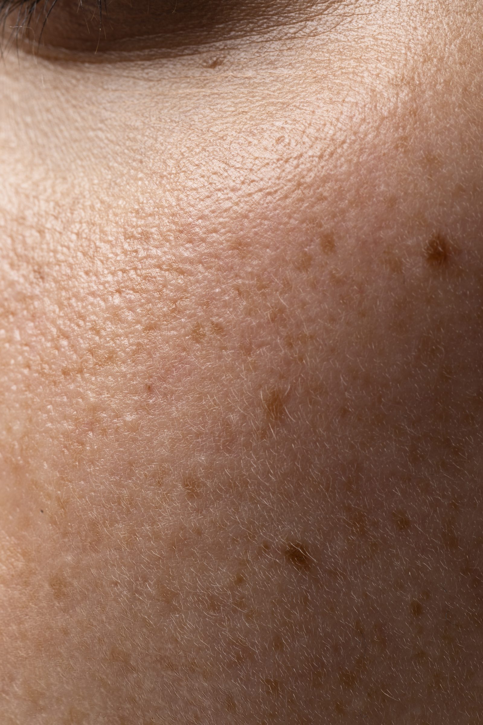 Cryotherapy at Toongabbie Doctors Cryotherapy at Toongabbie Doctors
