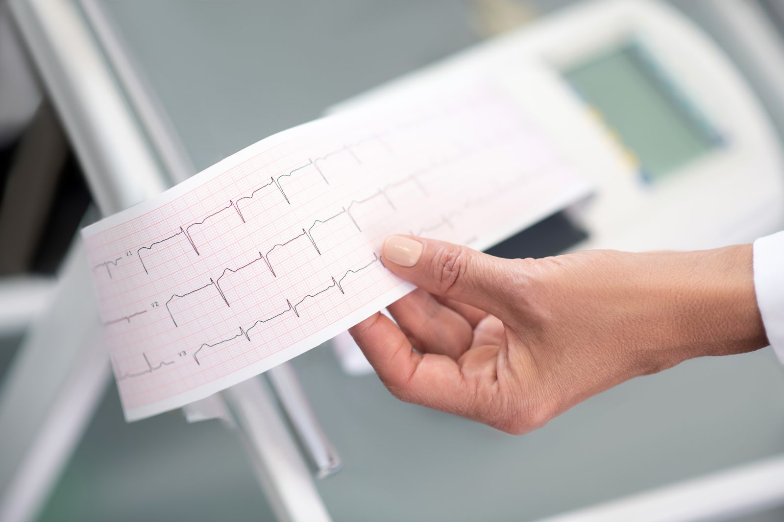 ECG, Spirometry and Pathology at Toongabbie Doctors ECG, Spirometry and Pathology at Toongabbie Doctors